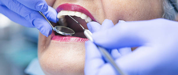 Best Emergency Dentist for Knocked-Out Tooth in Bethany, IL